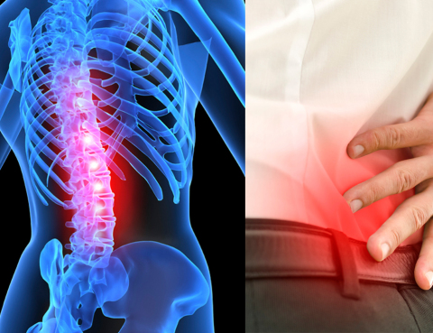 Spinal Stenosis Symptoms | Spine Works Institute