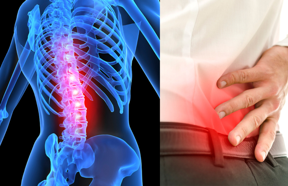 Spinal Stenosis Symptoms | Spine Works Institute