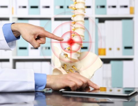 Herniated Disc Symptoms | Spine Works Institute